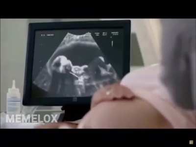 Ma’am it’s a boy!