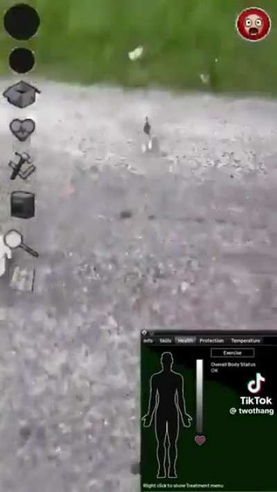Project zomboid moment. 