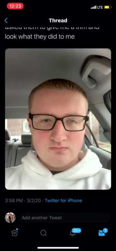 Playing Tic-Tac-Toe on a guy's forehead