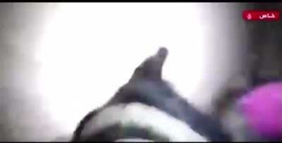 Idf dog attacking a 66 year old woman