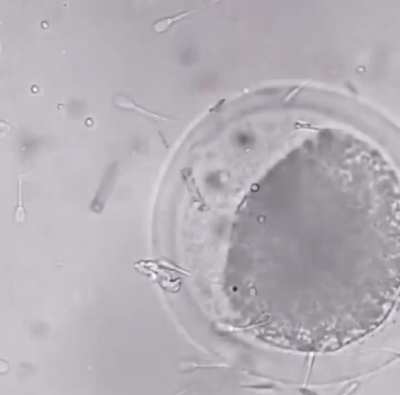 Nanobot assists one sperm to reach the egg
