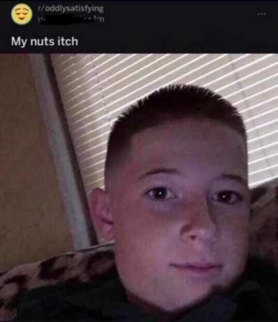 his nuts itch (found on discord)