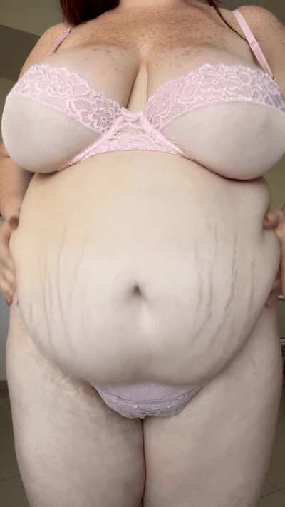 r my stretch marks a dealbreaker?
