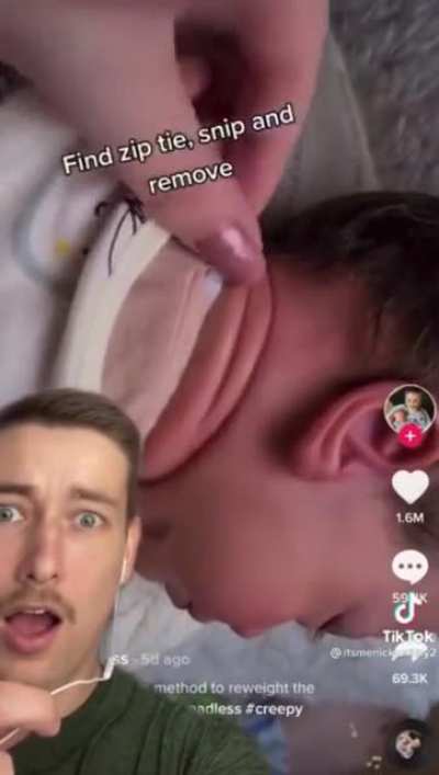 Ziptie around a baby’s head?