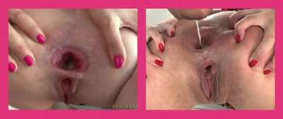 Attention Buttfuckers! Let’s take a poll: What do you prefer, Cumfarts or Gapeshots?