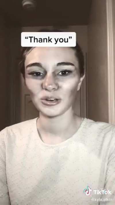 Literally why