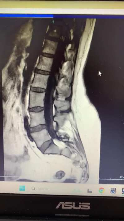 Does this look bad?