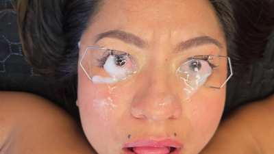 Eye speculum