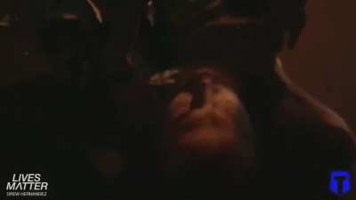 Protester gets hit in groin with a rubber bullet - MEDIC - Lancaster 13th September