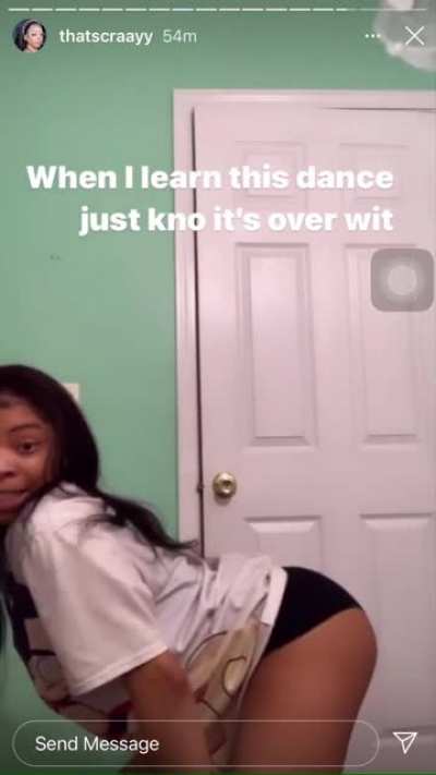 Ig story