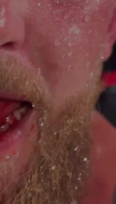 Jake Paul with a broken jaw post fight