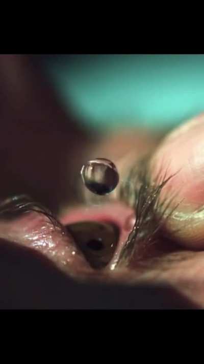 Eye drop in extreme slow-motion, recording in 28,500 frames per second