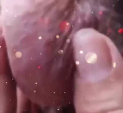 When you squeeze too hard!