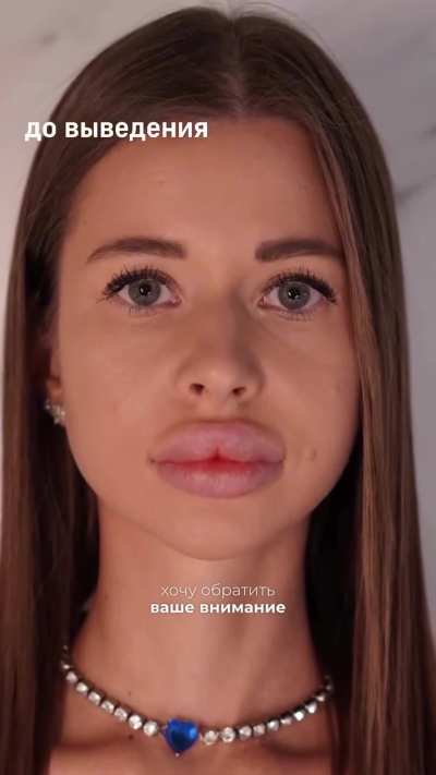 Before / After