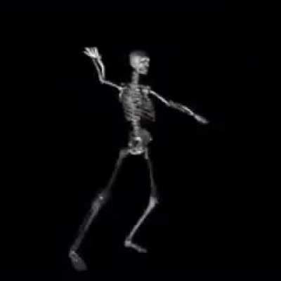 Skletono