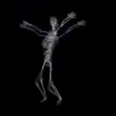 Skeleton