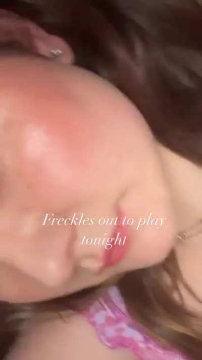 Freckles
