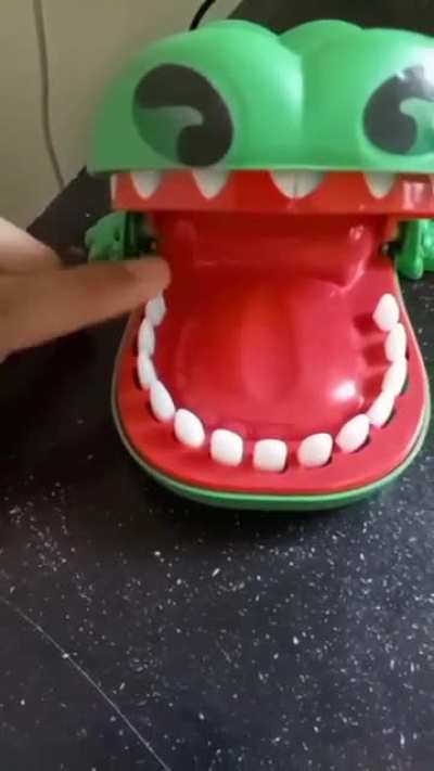 Crocodile ate man's finger, man screams!!