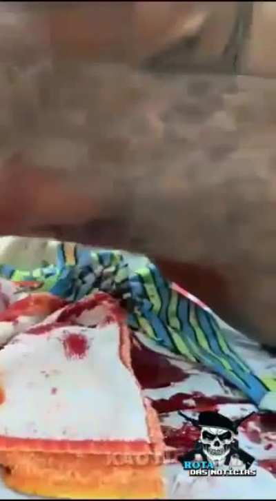 [NSFW] Aftermath of the guy who slammed his head on the ground when trying to jump on the pool