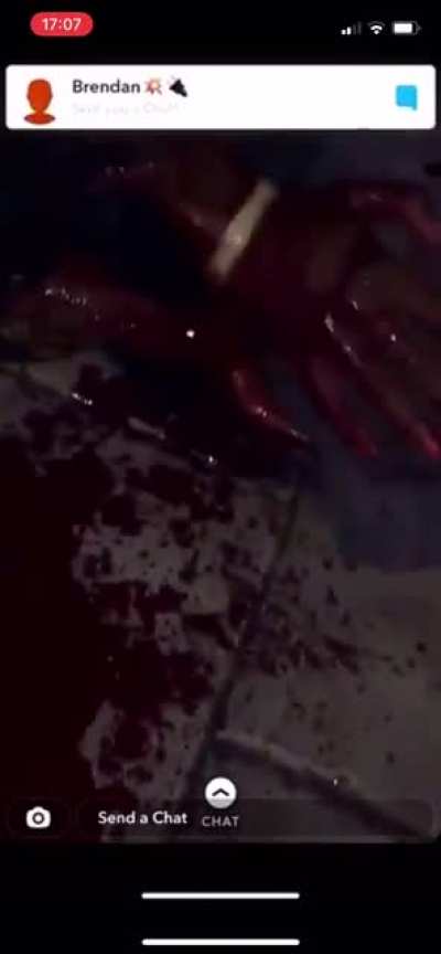 Aftermath of a Stabbing