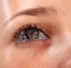 Thanks, I hate furry eyeballs.