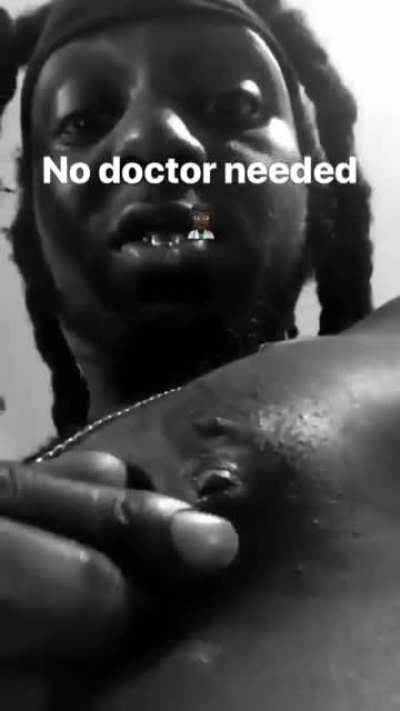 Go to the doctor you might live! shiiiidd ima take my chanc<wbr>es...<wbr>..and do it myself
