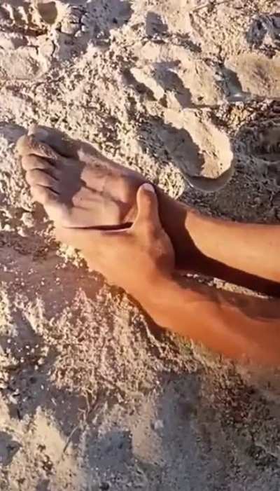 Man attempting a backflip ends up breaking foot
