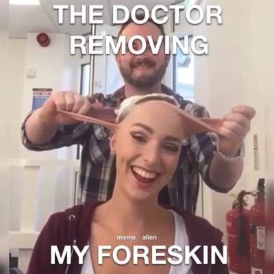 Now it’s 2 skin