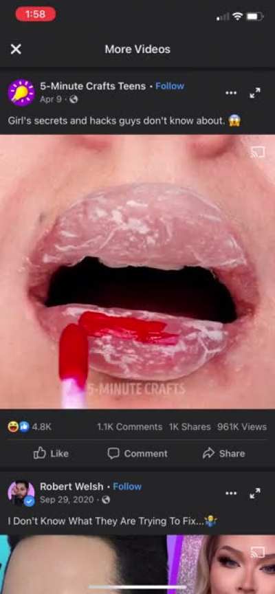 Just when you thought overfilled lips couldn’t get any worse