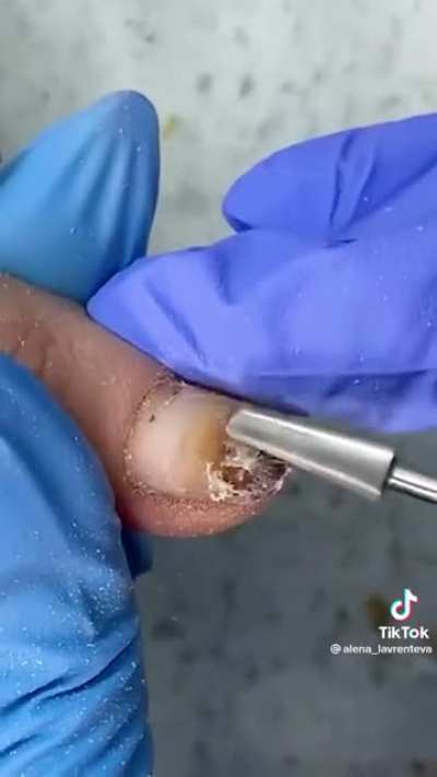 Imagine biting that