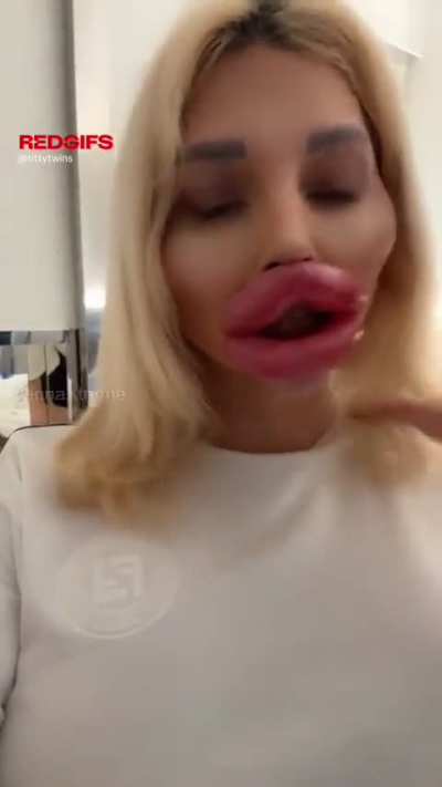 Rate my Lips from 1-10
