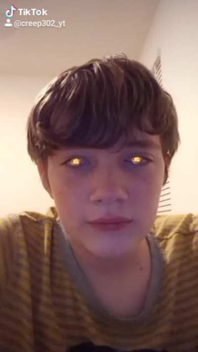 MY EYES ARE ON FIRE