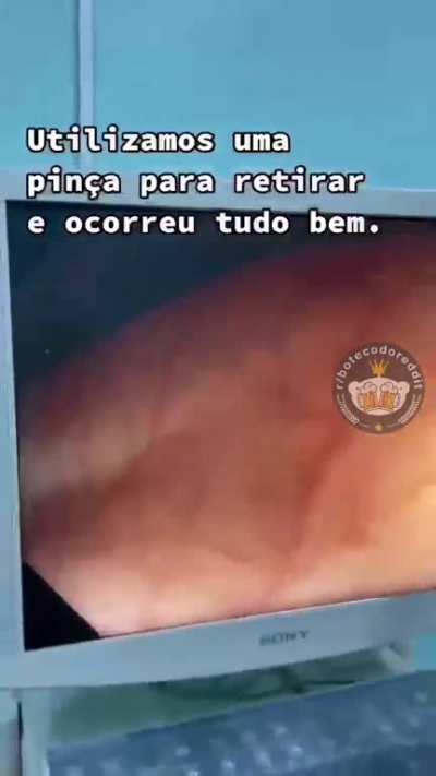 Tá, quem foi?
