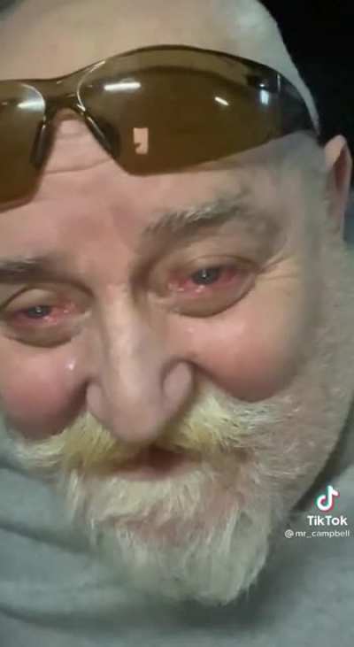 Needs a little visine