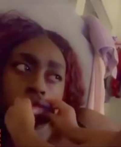 Child accidentally pops mother’s eye out