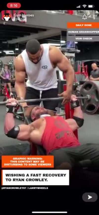 Weightlifter breaks pec tendon