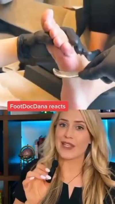 Foot cheese spread 