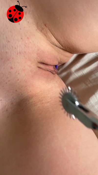 Getting teased with pinwheel makes me feel pleasure and pain