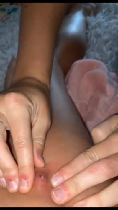 Squeeze