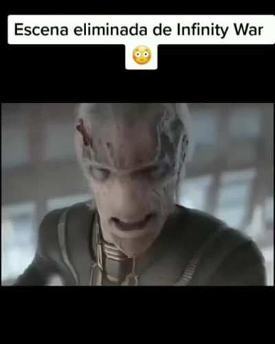 Xd