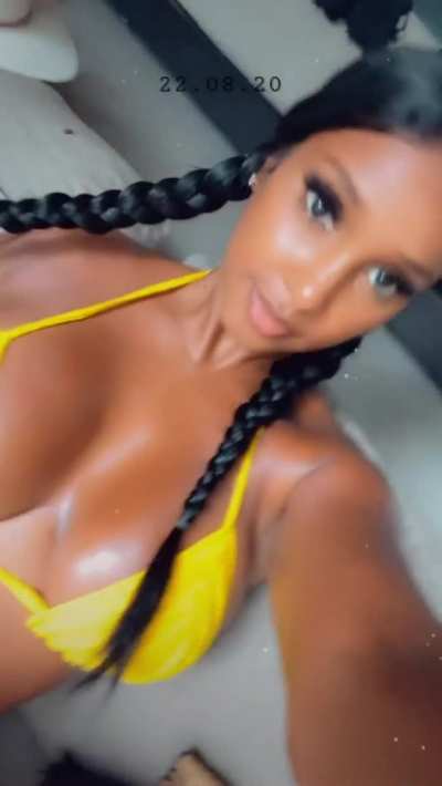 yellow fever