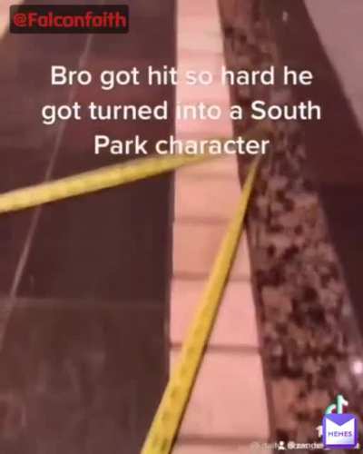 Bro got hit so hard he turned into a South park character.