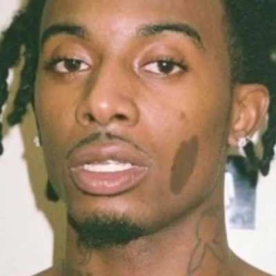 The Carti Birthmark 😍🧛‍♂️