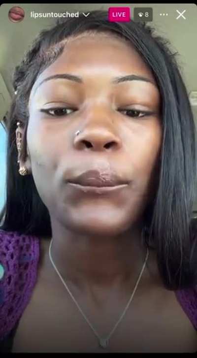 lips
