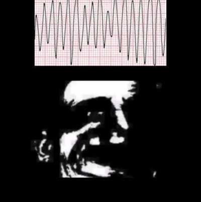 your rhythm is: damn irregular