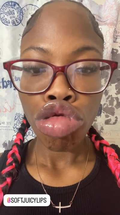Instagram @ soft_<wbr>juicy<wbr>lips_