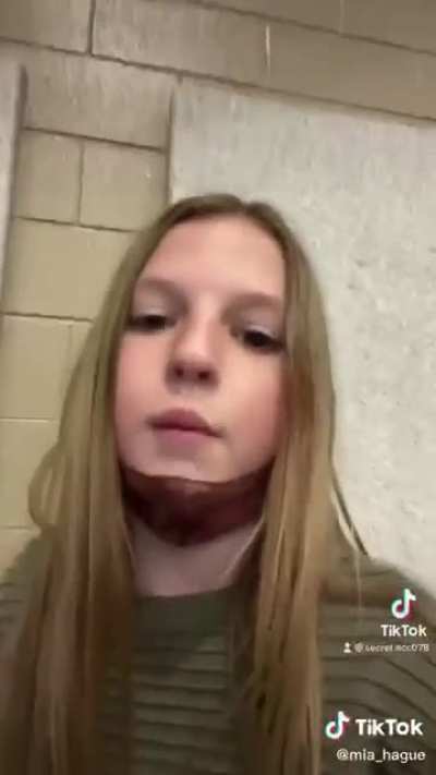 🤢🤢🤮🤮🤮🤮