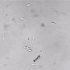 A nanobot performs artificial insemination of an egg