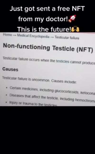 based nft😳