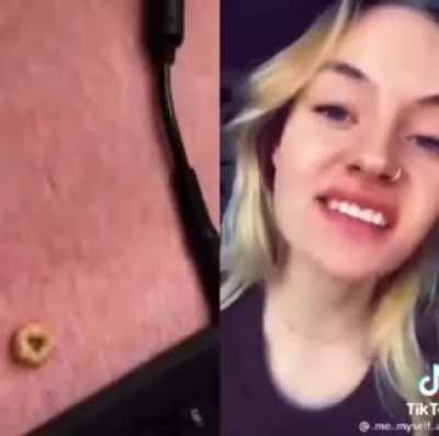 Fruitloop